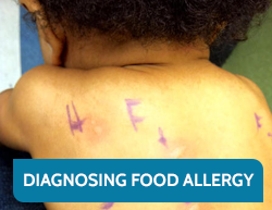 Diagnosing a Food Allergy