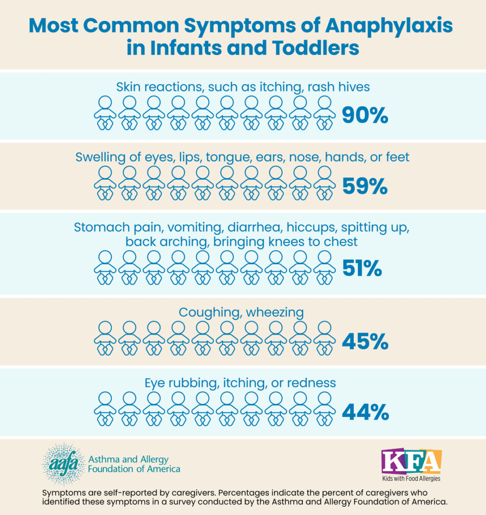 A chart showing the most common symptoms of anaphylaxis in infants and toddlers with percentages of how often they occur