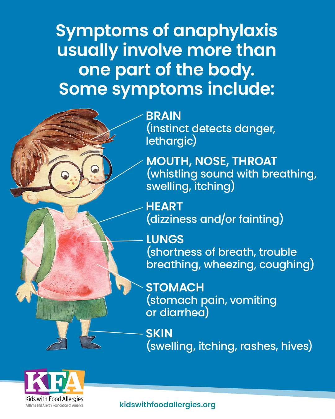 An illustration of a child with the text: Symptoms of anaphylaxis usually involve more than one part of the body. Some symptoms include brain, mouth, nose, throat, heart, lungs, stomach, and skin.