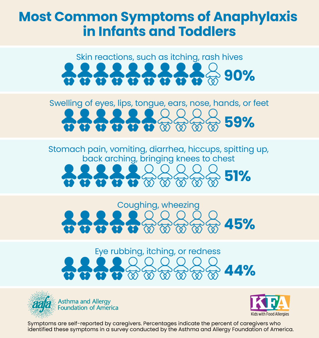 A chart showing the most common symptoms of anaphylaxis in infants and toddlers with percentages of how often they occur